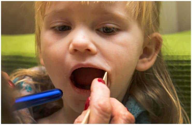 20 Interesting Facts About Scarlet Fever (Scarlatina) And Its Symptoms & Causes a