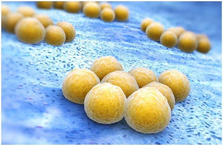 20 Interesting Facts About Staphylococcus Aureus + Symptoms of Staphylococcal Infections a