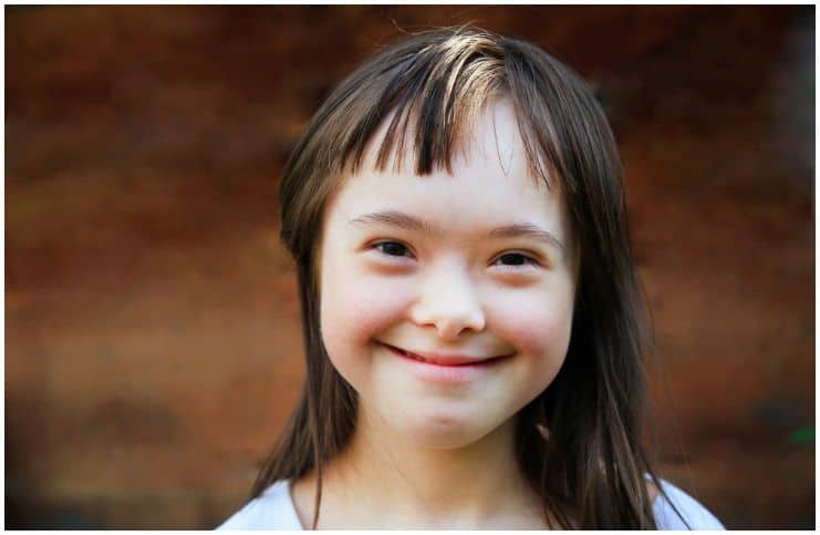 21 Interesting Facts About Down Syndrome + Statistics a (2)