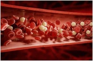 15 Interesting Facts About Atherosclerosis (Hardening Of The Arteries) a