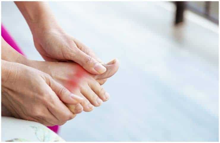 Colchicine vs Allopurinol - Which Is Better For Gout Treatment a