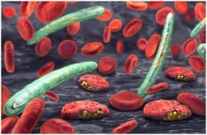 Malaria vs Yellow Fever - Symptoms, Causes, Differences a