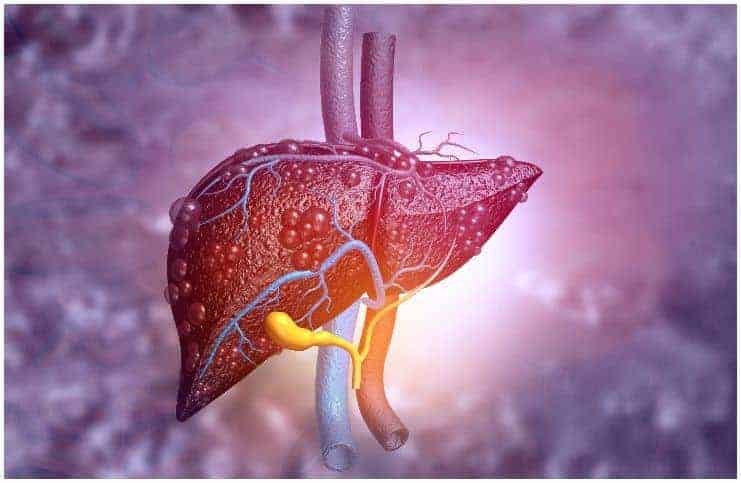 Spiritual Meaning Of Liver Disease & Liver Cancer a