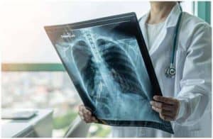 Atelectasis vs Pneumothorax (Collapsed Lung) - Differences a