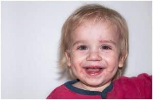 Smallpox vs Chickenpox - Differences a