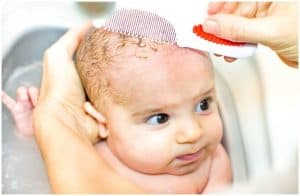 10 Essential Oils For Cradle Cap (Infantile Seborrheic Dermatitis)