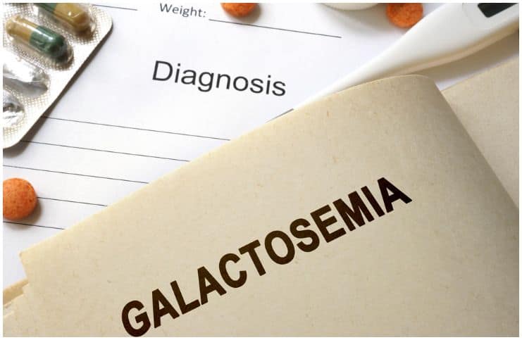 22 Interesting Facts About Galactosemia + Statistics