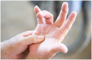 10 Essential Oils For Trigger Finger (Stenosing Tenosynovitis)