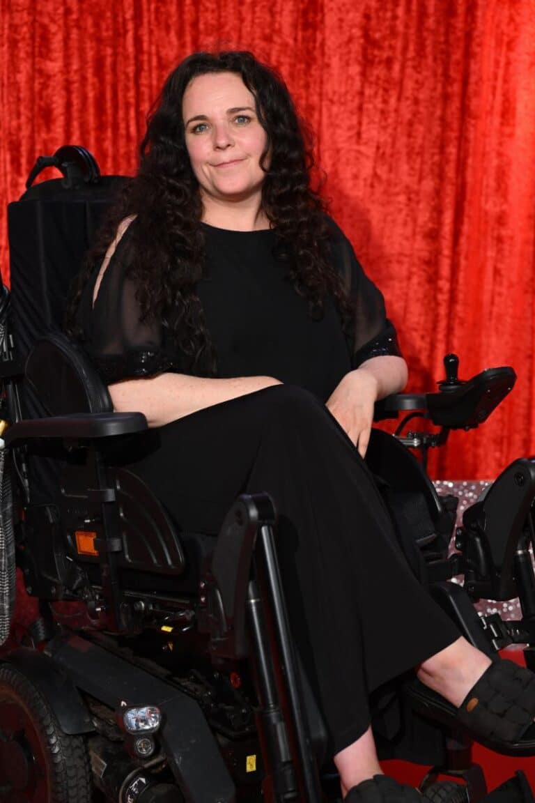 9 Famous People With Ehlers Danlos Syndrome (EDS) Your Health Remedy